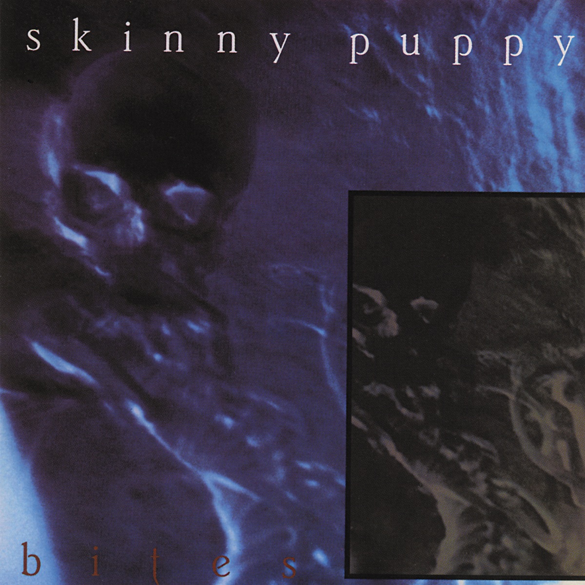 Обложка Skinny Puppy — Bites